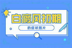 『重点咨询』太阳晒伤后出现白斑图片-长白斑的原因