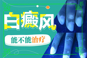 皮肤长白斑了怎么治疗-白殿疯治疗方法-怎么更好治疗