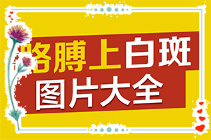 脸部有白斑的原因造成的[造成白斑病的原因]为什么身上出现白块