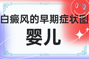 「远虑与近忧」腿上长了很多白斑是怎么治疗「关注订阅」白癞风怎么治疗