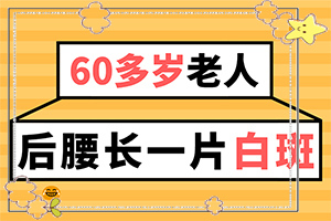 治疗白癜风阜阳哪家医院好[专业规范]如何治疗白癜风好
