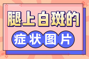 打针治疗白斑有用吗[正常接诊]如何治疗皮肤白癜风