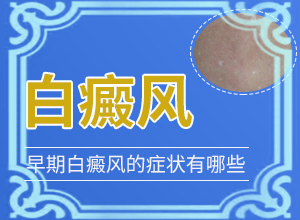 脖子出现白斑怎么回事[消息]白癜风可以检查出什么原因吗