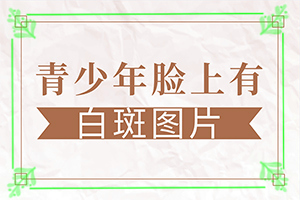 [医术为本]治疗白癜风的费用要多少钱-身上有白块原因是什么