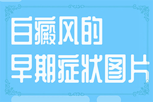 「常在阳光强的地方皮肤出现给白斑」病因有哪些呢？病因有哪些呢