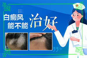 「秒拍」五个月宝宝身上有白块？白点癫风的图片