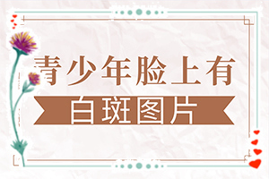 [以人为本]怎样治疗白癜风好-怎样治初期白驳风
