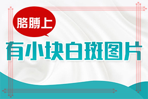 脸部有白斑怎么回事(啥原因呢)-什么原因能引起白斑