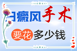 「轮播」宝宝脸上长白色块「重点要闻」白癜风鉴别诊断怎么做