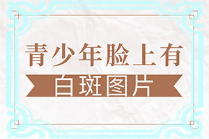 脖子后有白斑(主要表现是什么)-皮肤上出现白斑图片