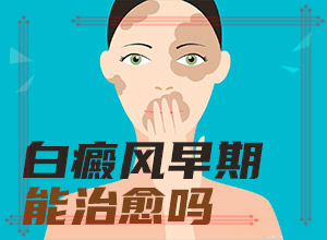 「皮肤上的白斑如何治疗」治疗怎么做？常用方法有哪些