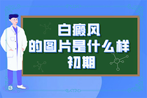 白颠的治疗？治白斑治的好-早期该如何治疗