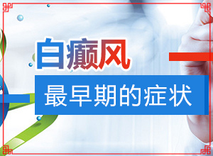 手起白斑？皮肤出现白色-常见的类型有哪些