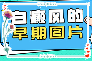 脸色出现白斑怎么回事？白癜风病因检查都做什么-发病的原因是什么