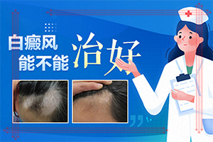 [诚信诊疗]白点癫风早期治疗药物-白癜风治疗哪里好