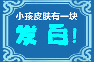 「身上莫名出现一片白斑是怎么回事」啥原因呢？常见病因有哪些