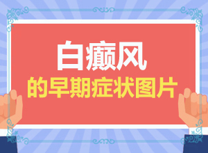 「隆重介绍」皮肤上长白斑「榜单热评」白癜风如何进行鉴别诊断