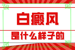 「皮肤科排行」手有白斑怎么回事？身上有白斑块是什么病