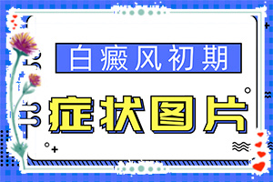 「女孩子脸上有白斑」又有哪些症状表现呢？有什么症状呢