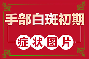 白癫疯能吗，吃什么药能出,应该如何治疗(如何避免误治)