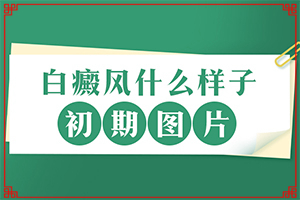 镀铬条氧化起白斑怎么处理[更新]合肥治疗白癜风哪家呀