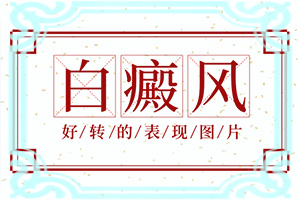 脸上白斑是什么原因(什么原因会诱发)-白颠是什么原因引起的