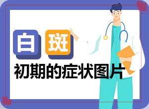 白癞风怎么可以跟治吗[这有几种好方法]如何治疗皮肤白