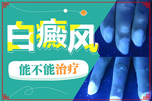 白斑症状初期,如何自我诊断(有图有真相)