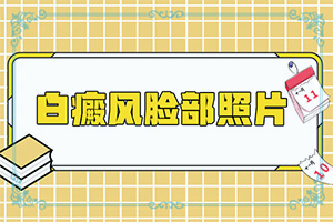 [专业服务]出现白斑是怎么回事-皮肤上有小白斑点是什么原因