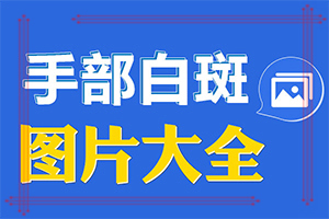 「这几年我身上出现好多白斑 为什么」病因有什么？哪些诱因引起