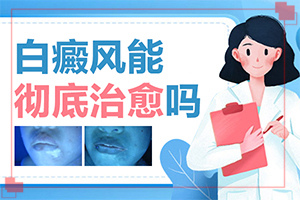 「纪实榜单」上嘴唇有白色斑点？白癜风确诊检查什么
