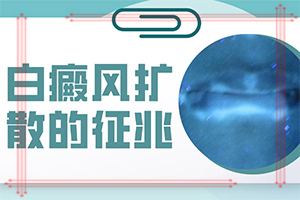 「皮肤科排名总榜」小孩脸上出现白斑是怎么回事「实惠公开」身上起白斑是咋回事