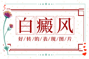 身体有块白班15年不显示是什么斑？如何区分