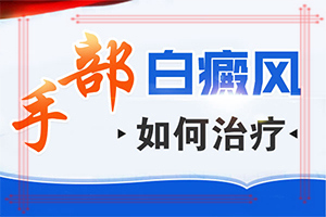 「重点要闻」白殿风怎么办？白癞风可以治疗好吗